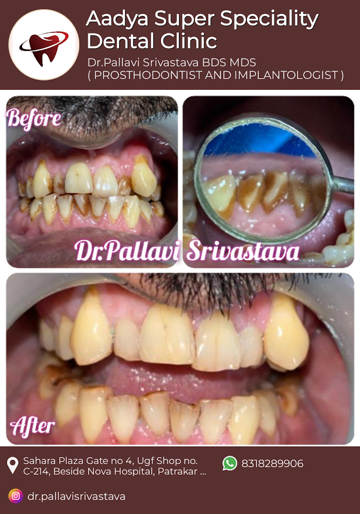 Dr. Pallavi Srivastava, Dentist, Prosthodontist and Implantologist in Gomti Nagar, Lucknow